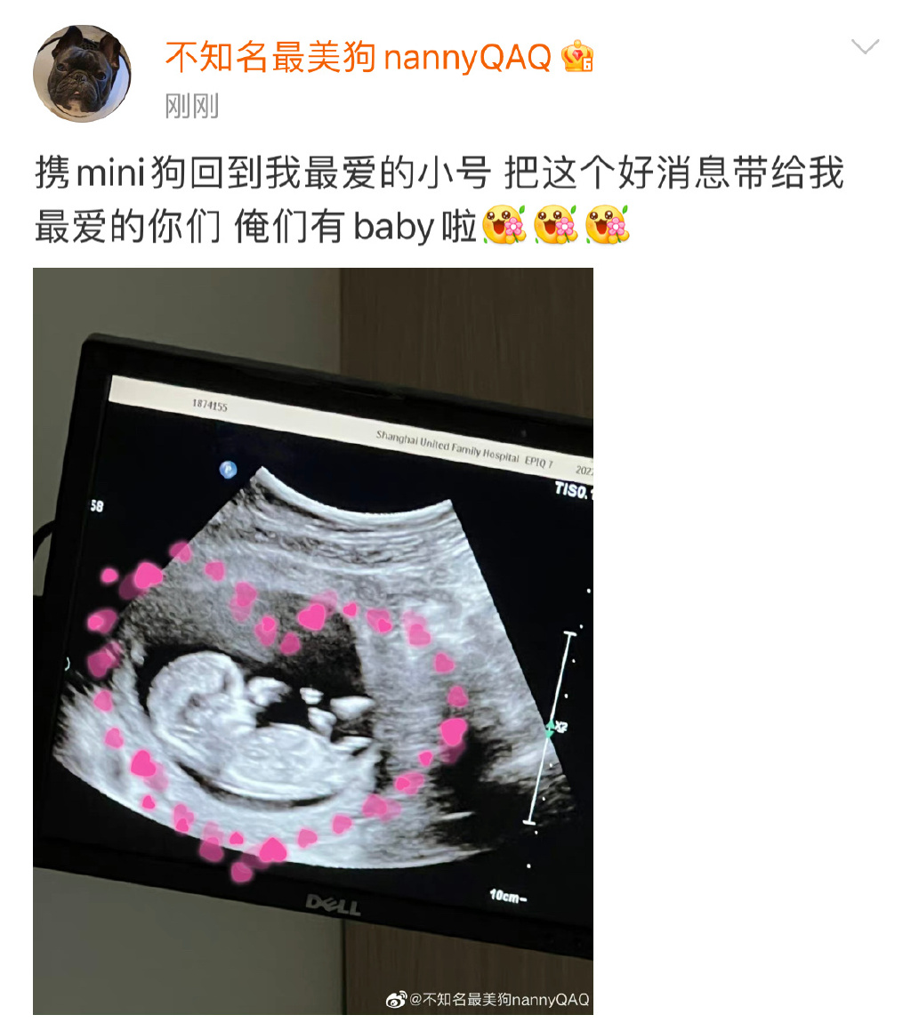 Uzi女友婷婷发博：俺们有Baby啦